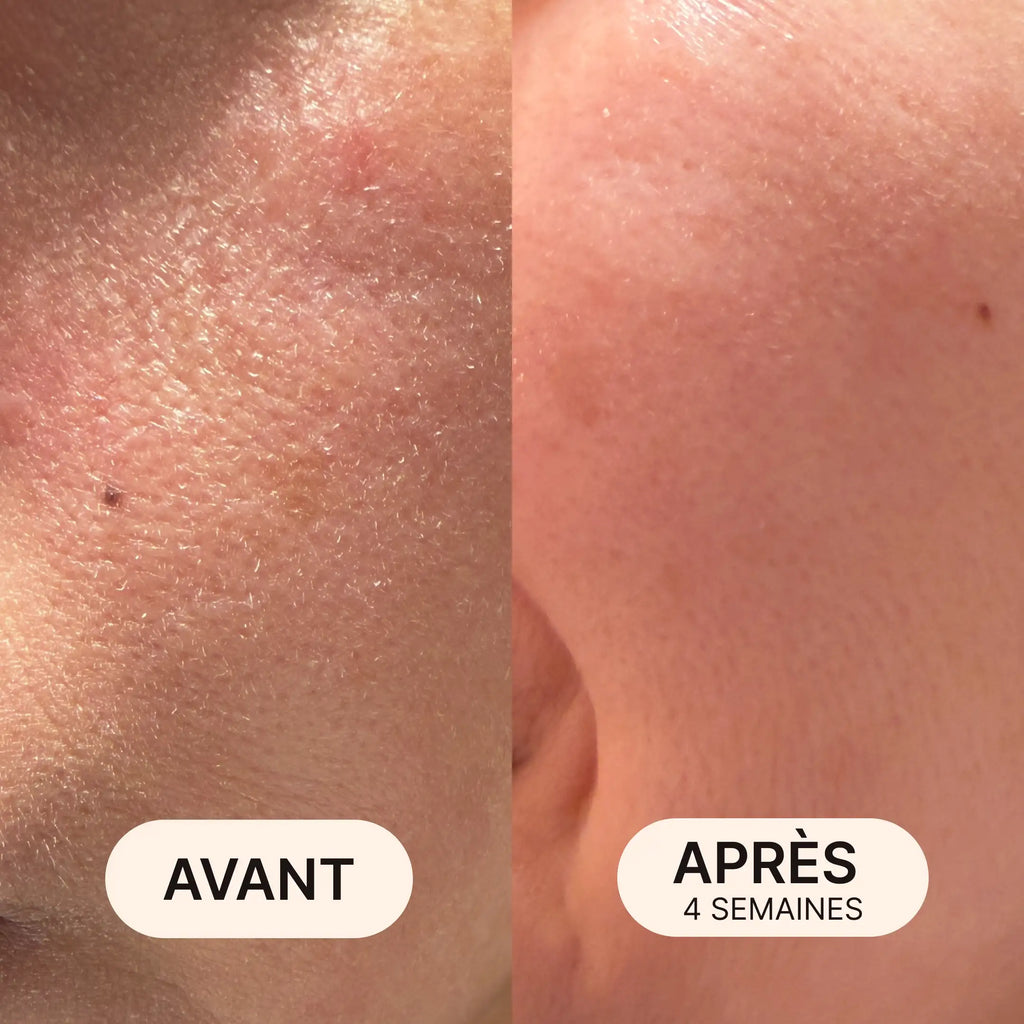 Routine Peau douce, hydratée & repulpée